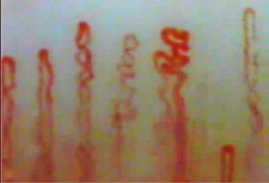 毛細血管スコープ　血管美人　SC-10