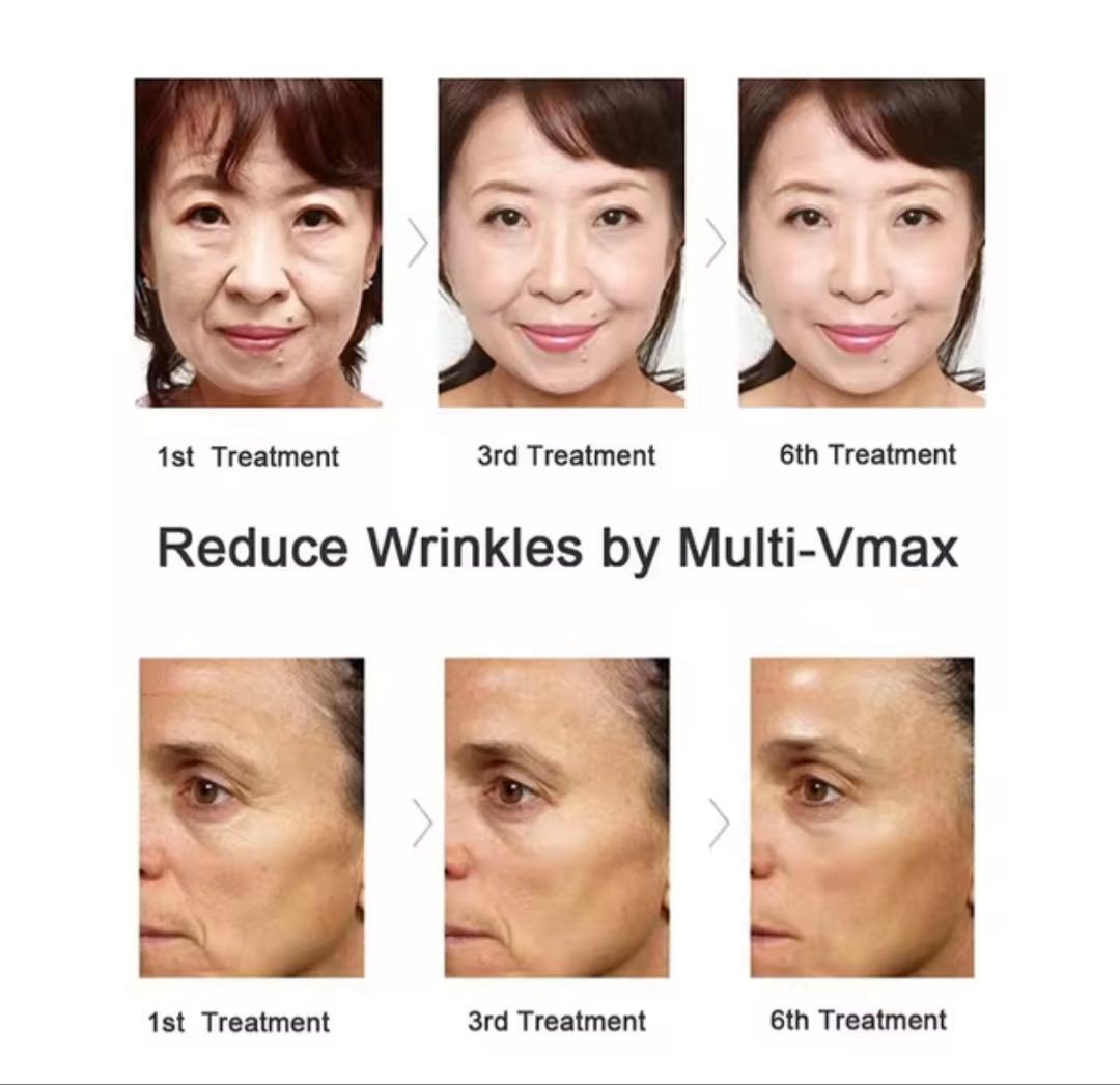 Vmax 美容機器 タッチスクリーン シルバー