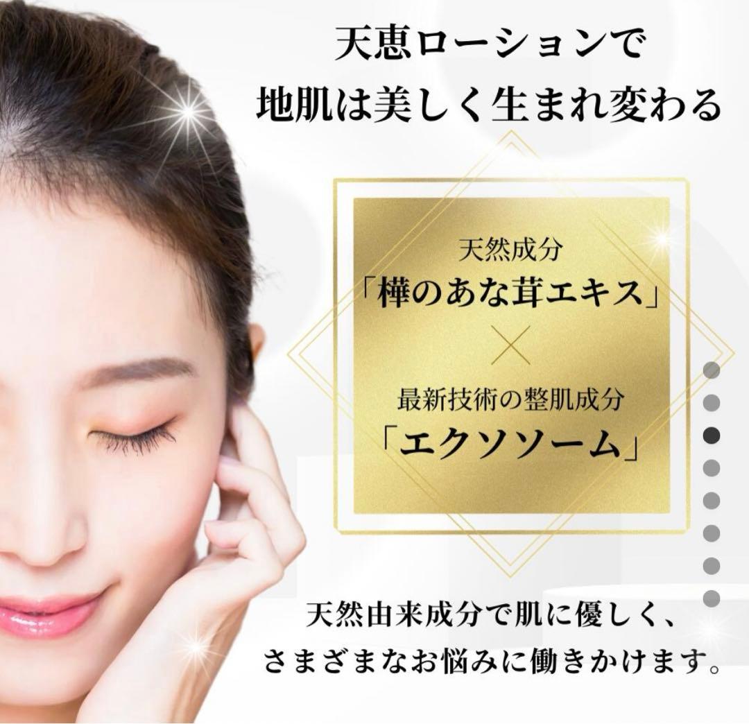 天恵ローション