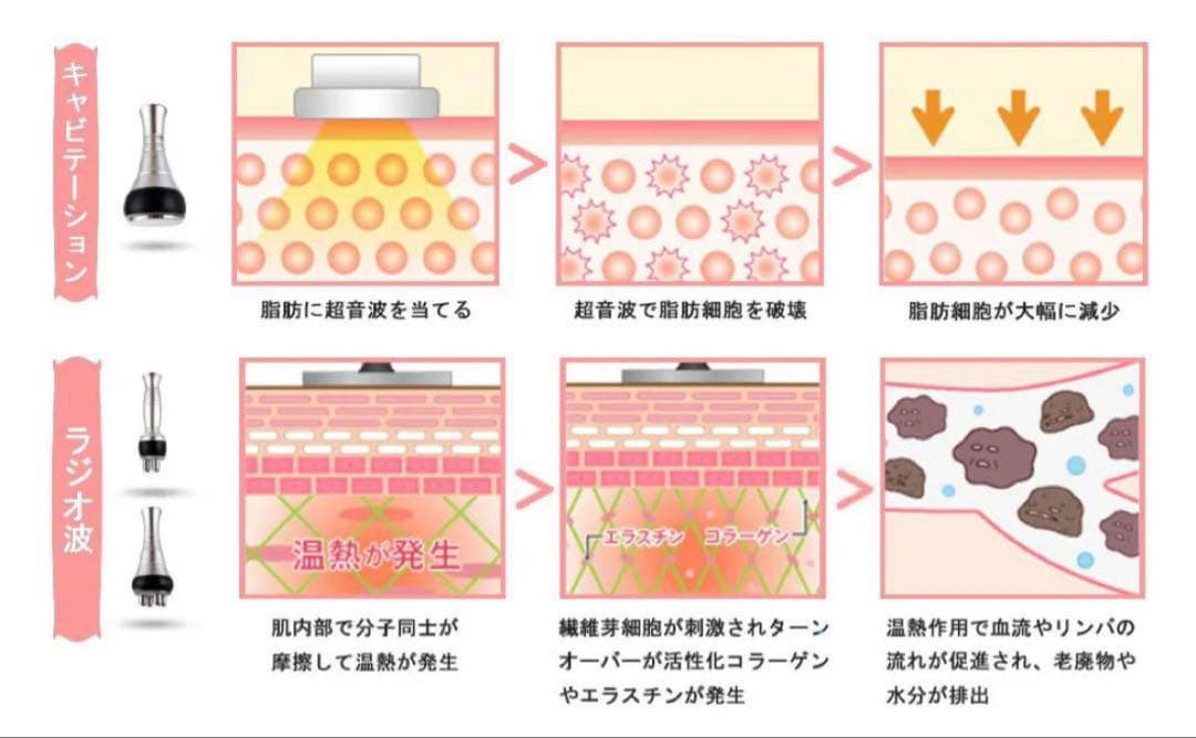 40Khzキャビテーション 光ラジオ波 多極RF ボディ スリミング 業務用