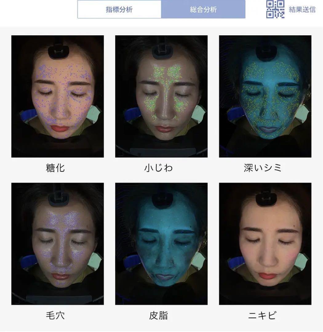 Uchimura Tom専用 エステサロン肌診断機